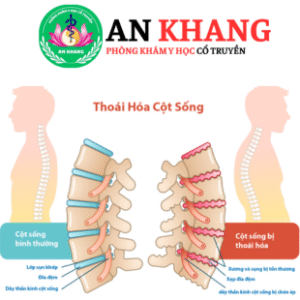 Thái hóa cột sống