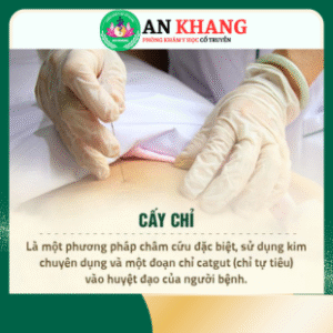 cấy chỉ